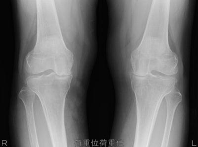 knee150505.jpg