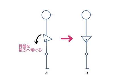 骨盤後傾.JPG
